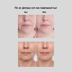 Ansikte & Hals Lyftare Pro