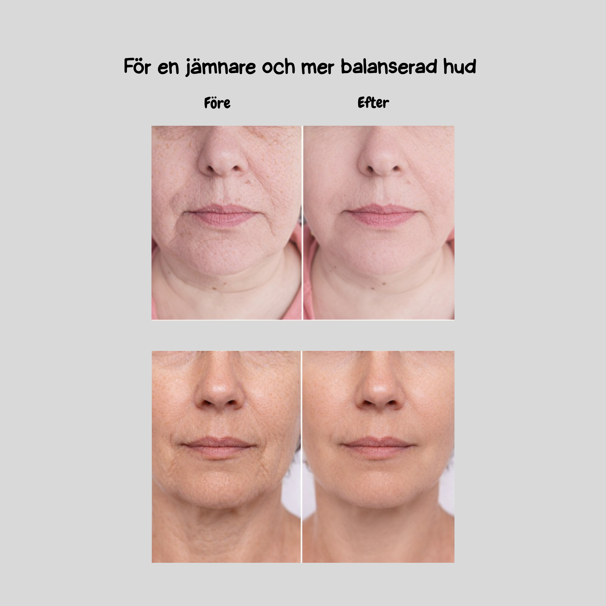Ansikte & Hals Lyftare Pro