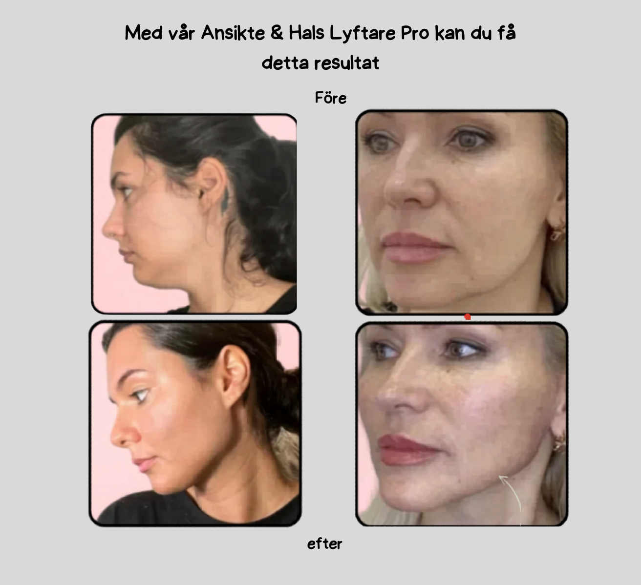 Ansikte & Hals Lyftare Pro